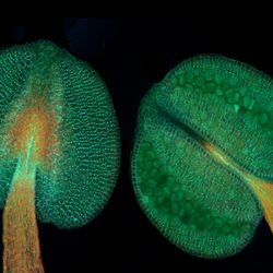 Anthers of thale cress (Arabidopsis thaliana)