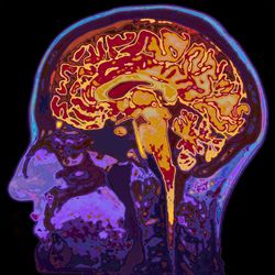 Brain ageing.