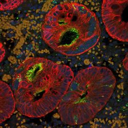 colourful microscopy image showing appendix cells infected with fluorescently labelled measles virus