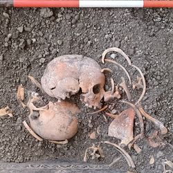 The skull of a Pompeii victim