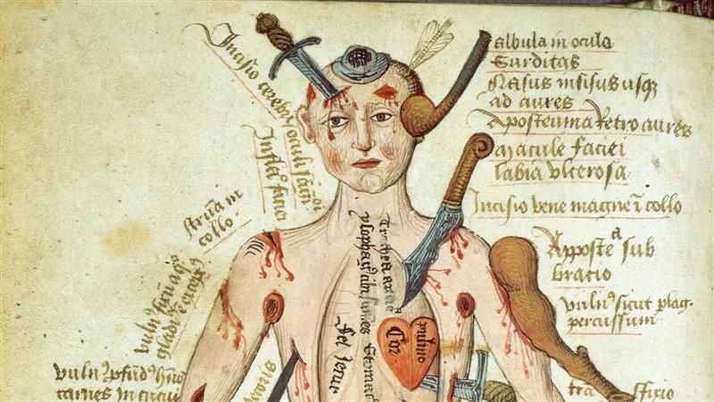 A cropped photo of the Wound Man's upper body and head. The illustration shows the various weapons sticking out of his upper torso, including clubs, knives, swords, spears and arrows. Surrounding these weapons are textual labels in Latin.