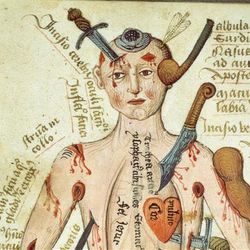 A cropped photo of the Wound Man's upper body and head. The illustration shows the various weapons sticking out of his upper torso, including clubs, knives, swords, spears and arrows. Surrounding these weapons are textual labels in Latin.