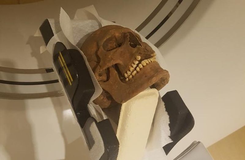 A Viking era skull being scanned