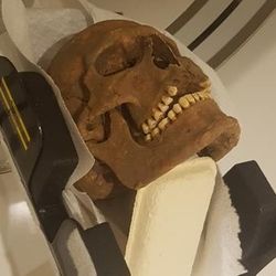 A Viking era skull being scanned