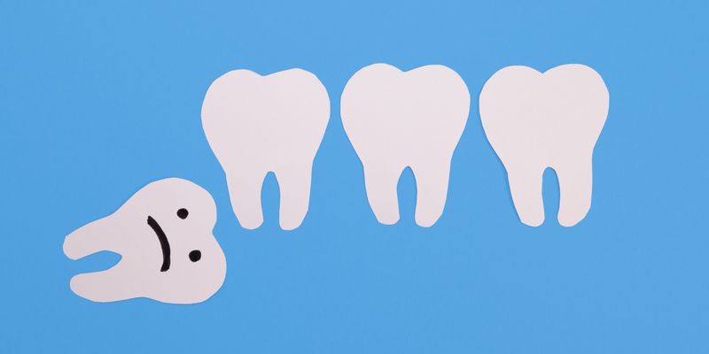 paper cutouts of three human teeth on a blue background, with an extra one lying on its side on the left with a sad face drawn on it