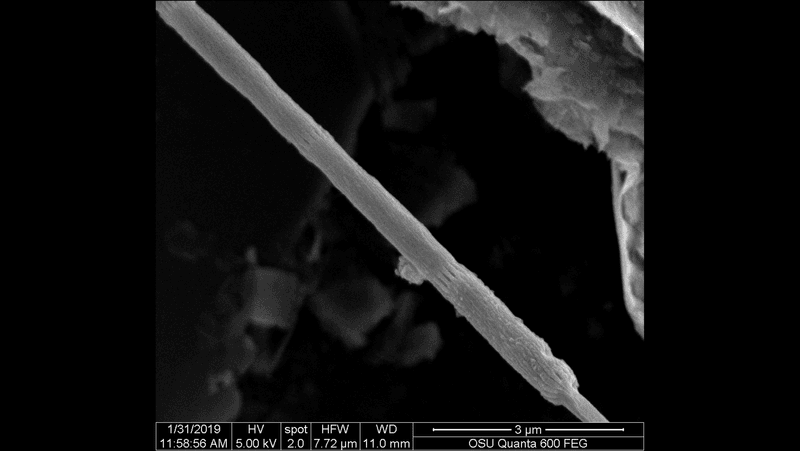 microscope image (black and white) of a long, filamentous bacterium