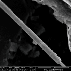 microscope image (black and white) of a long, filamentous bacterium