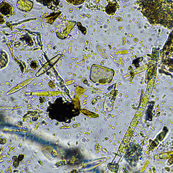 Top soil microbes under a microscope.