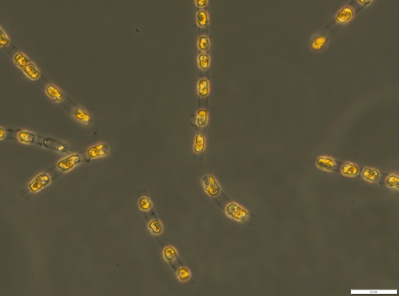 They look like beads of Baltic amber, but these are single-celled organisms revived from almost 7,000 years of dormancy at the bottom of the Baltic Sea