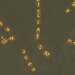 They look like beads of Baltic amber, but these are single-celled organisms revived from almost 7,000 years of dormancy at the bottom of the Baltic Sea