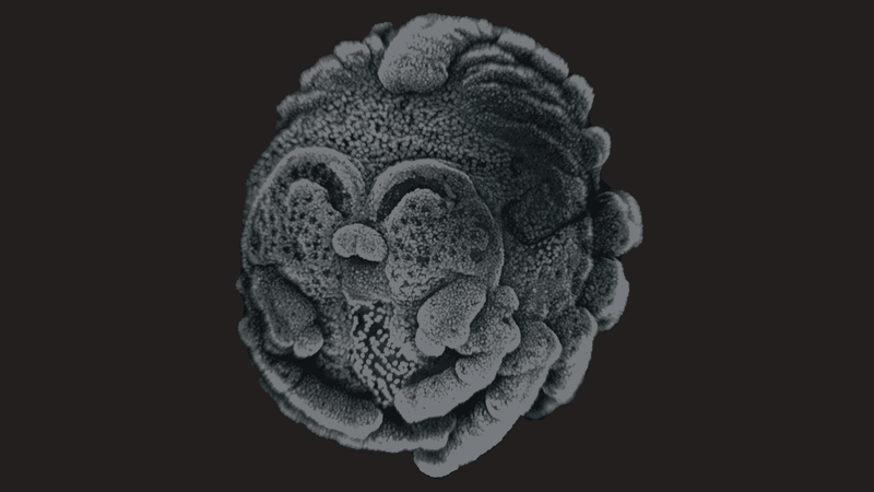 A black and grey ball that is the embryonic stage of a spider. The legs just forming.