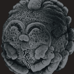 A black and grey ball that is the embryonic stage of a spider. The legs just forming.